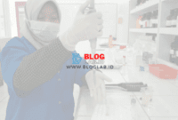 Hemoglobin Metode Sianmethemoglobin