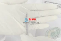 Pemeriksaan Hematokrit Menggunakan Metode Makrohematokrit
